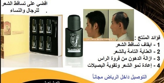 Queda de cabelo do tratamento da queda de cabelo da transplantação do cabelo da cura da queda de cabelo nas mulheres 6 * 50ml