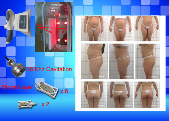 Cryo que congela o peso do equipamento do laser Lipo perde a máquina home da beleza