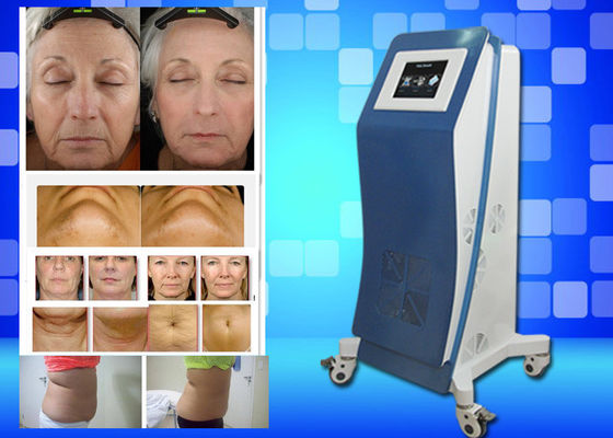 Cryo que congela o peso do equipamento do laser Lipo perde a máquina home da beleza