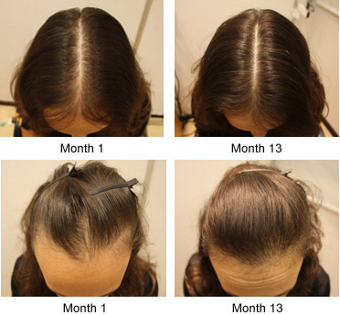 Líquido denso do cabelo do cabelo adicional real do golpe do shou in1 do crescimento 6 do cabelo do sunburst do resultado